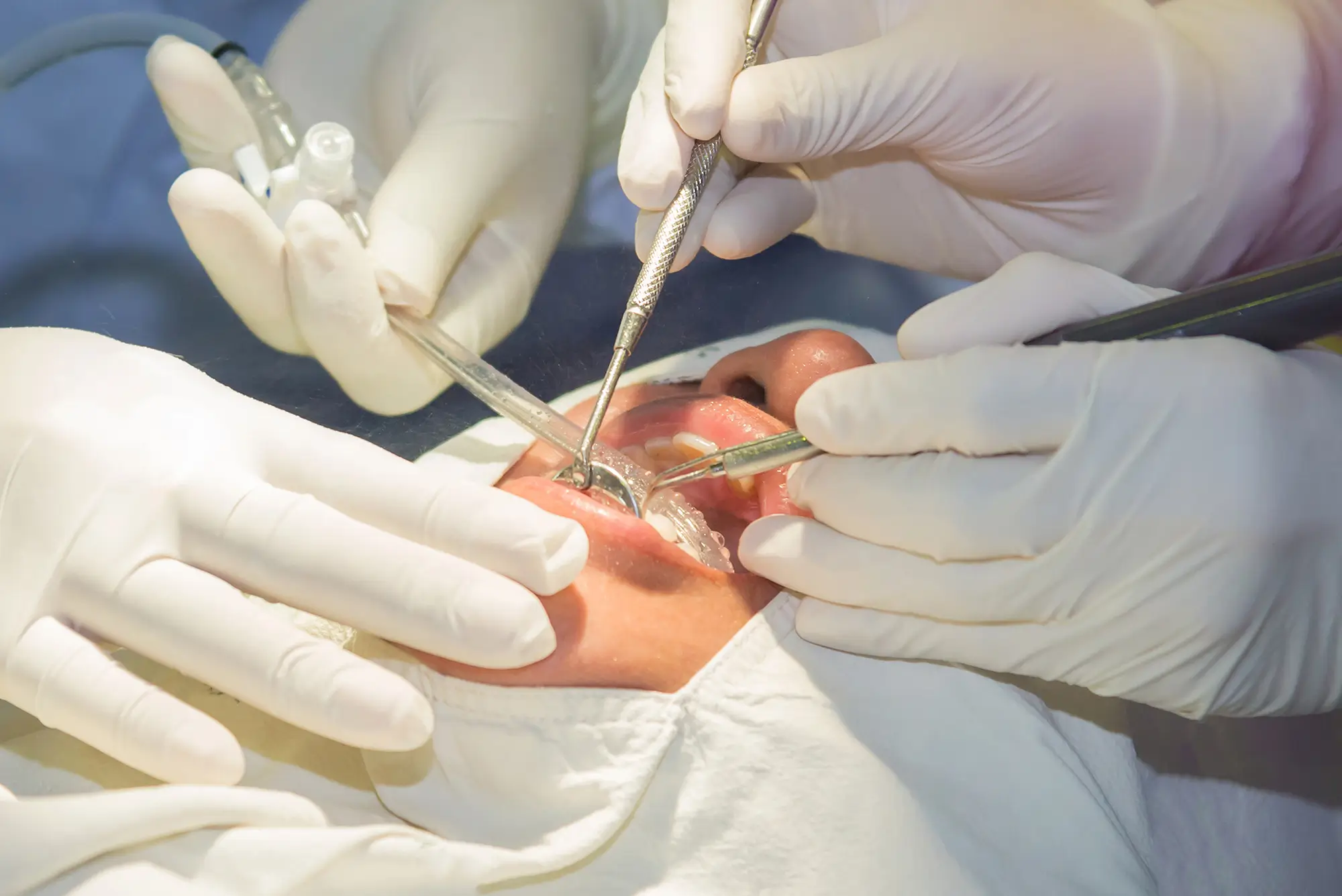 Cirurgia