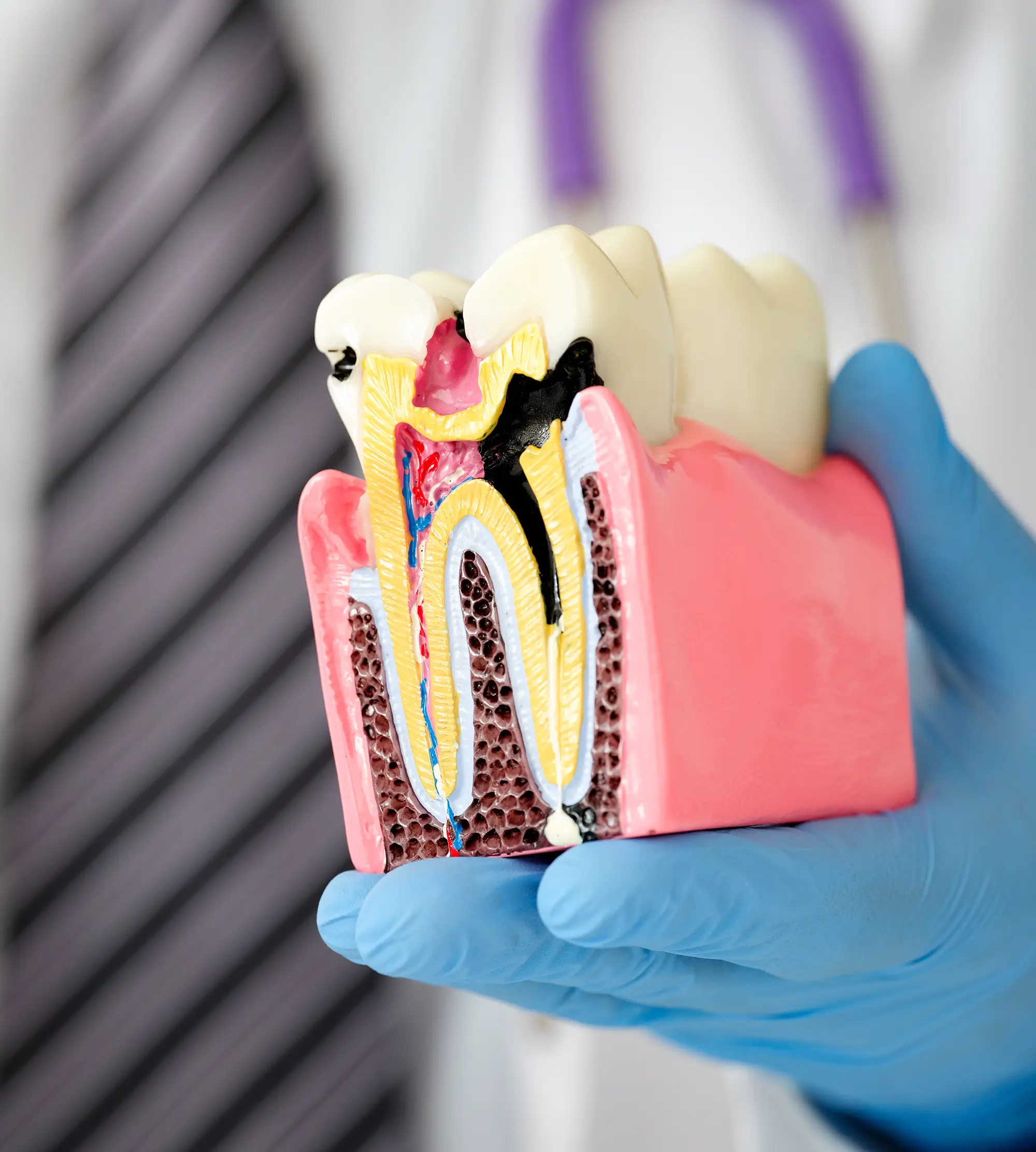 O que é endodontia?