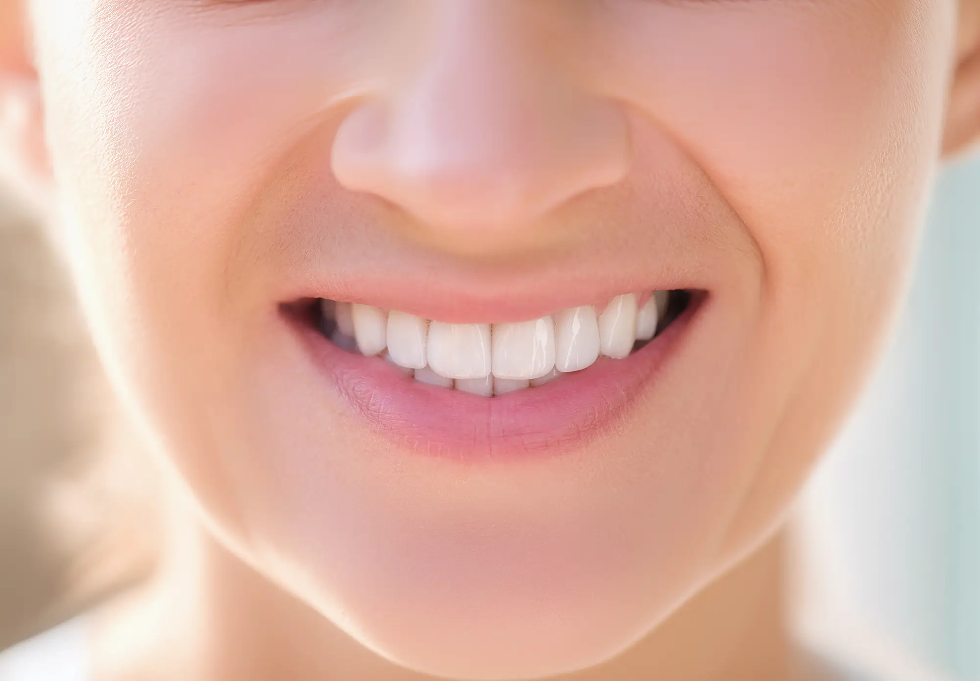 O que são lentes de contato dental?